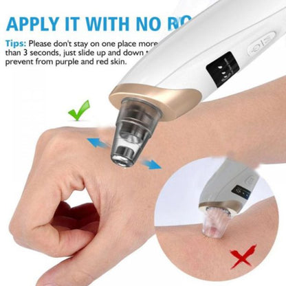 Blackhead Suction Remover